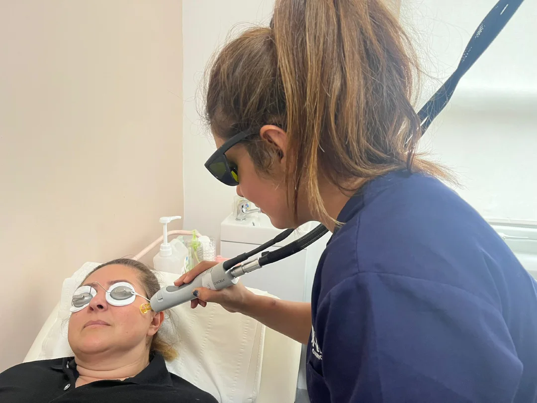 Laser Skin Resurfacing