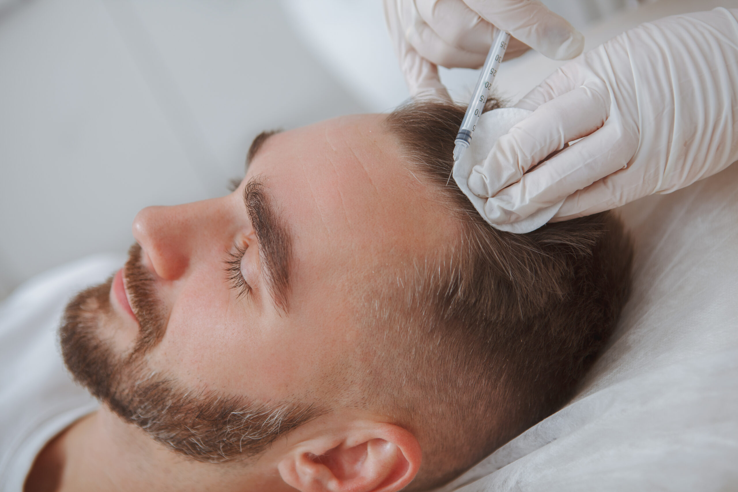 Platelet Rich Plasma (PRP Hair) - 3 sessions