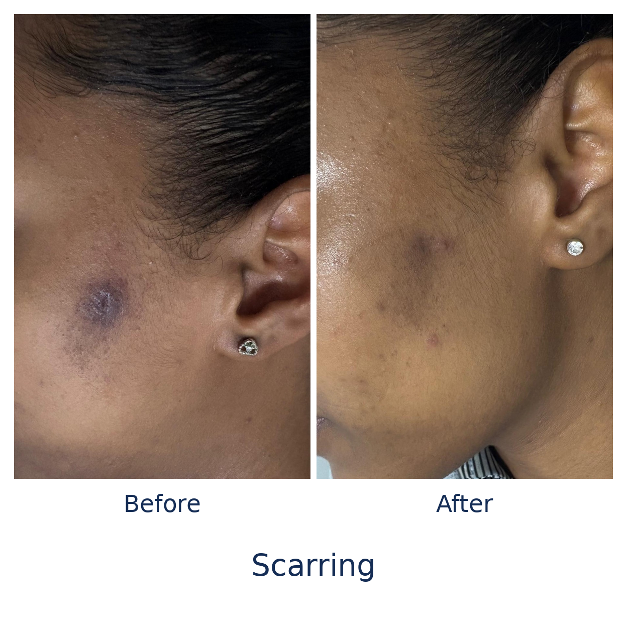 Scarring_Genuine_Before_After (1)