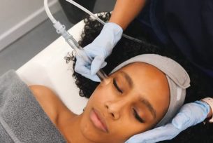 Hydrafacial 3